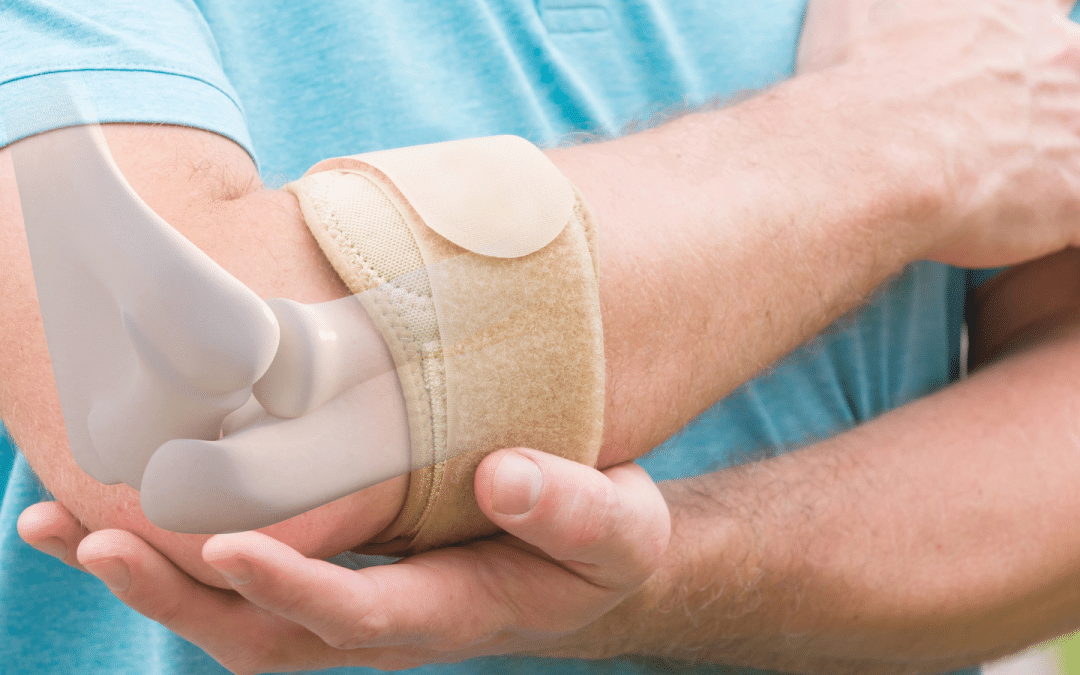 Effective Tennis Elbow Exercises: Rehabilitation and Treatment Guide