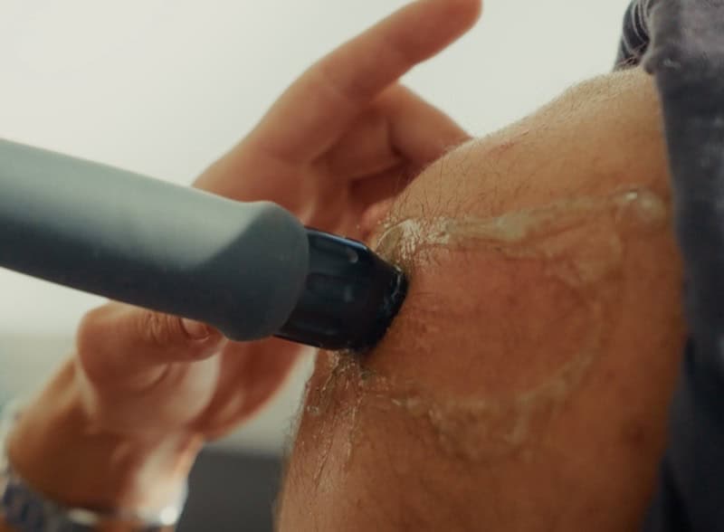 Physiotherapist performing deep tissue therapy on shoulder for pain relief and recovery.