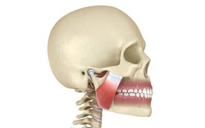 Understanding Temporomandibular Joint Disorders